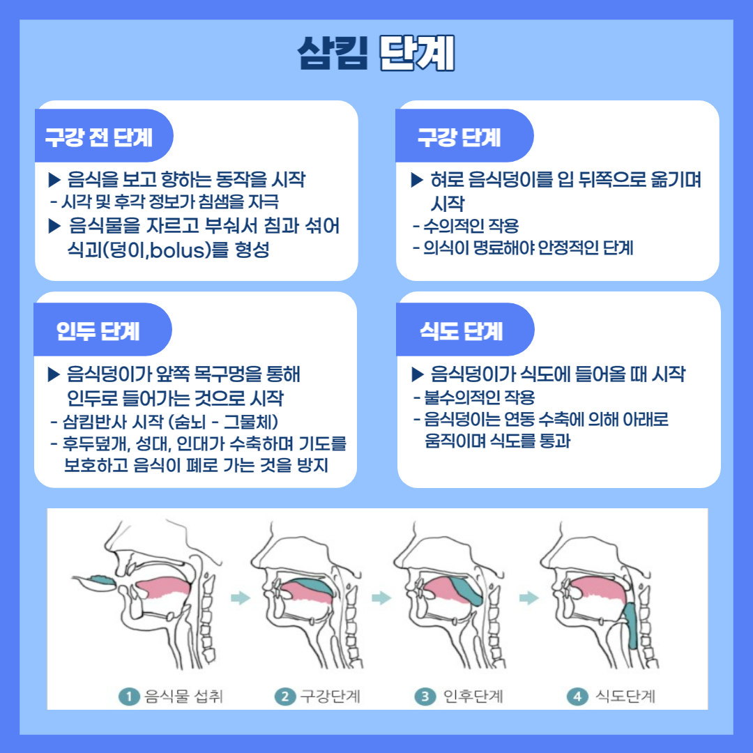 작업치료-연하(삼킴)장애 알아보기
